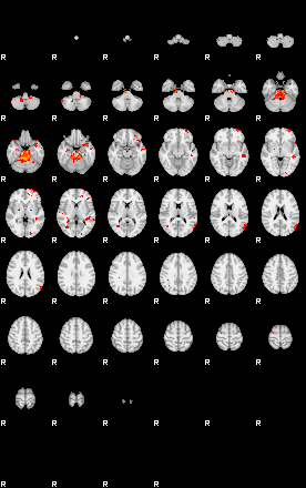 Patients 29281 34