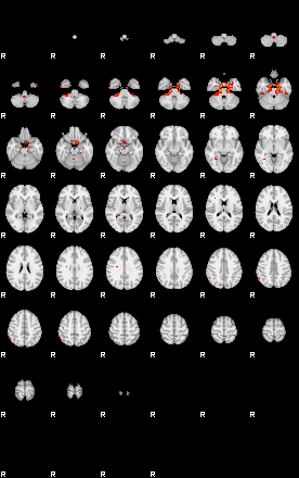 Patients 29289 95