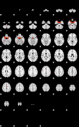 Patients 29291 30