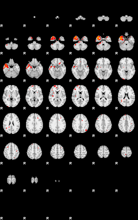 Patients 29394 35