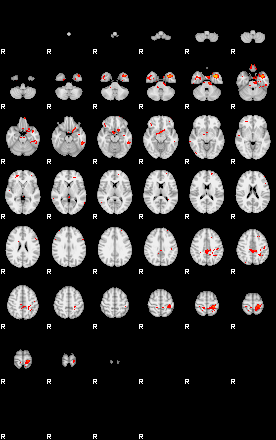 Patients 29401 154