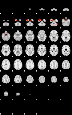 Patients 29411 102