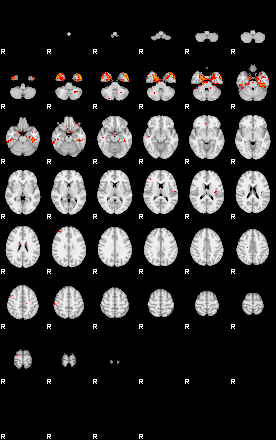 Patients 29415 94