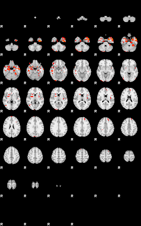 Patients 29479 77