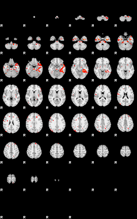 Patients 29515 158