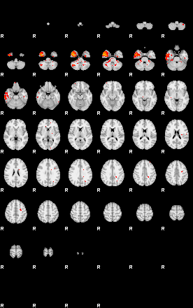 Patients 29516 99