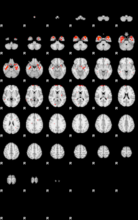 Patients 29559 3