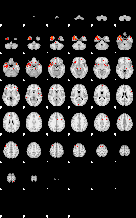 Patients 29591 133