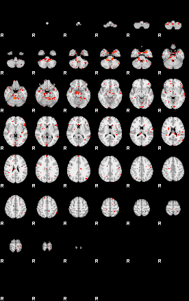 Patients 29610 56