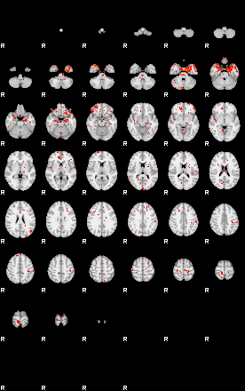 Patients 29613 33