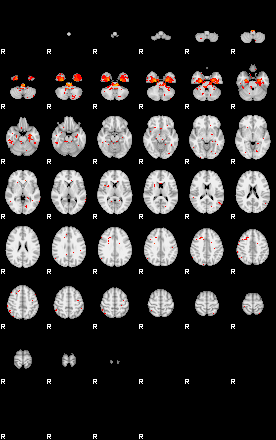 Patients 29629 28