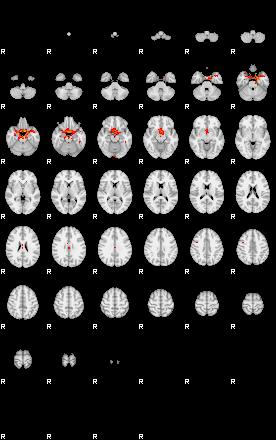 Patients 29657 27