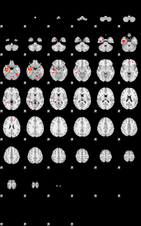 Patients 29670 3