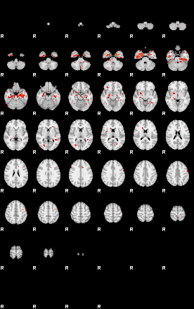 Patients 29735 90