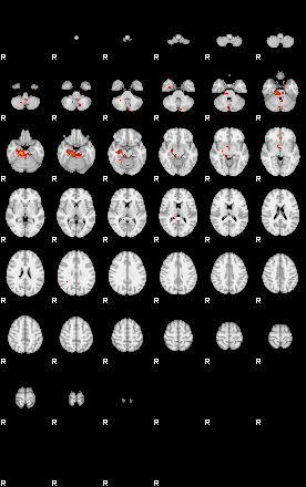 Patients 29797 13