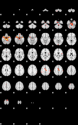 Patients 29879 14