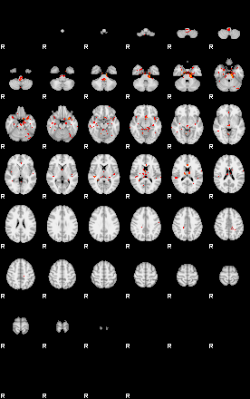 Patients 30018 17