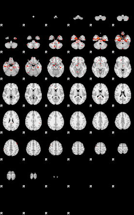 Patients 30168 4