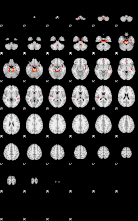 Patients 30178 13