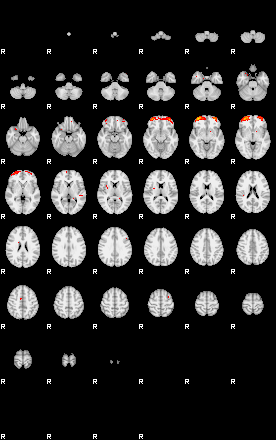 Patients 28819 171