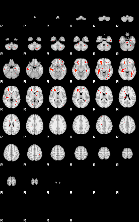 Patients 28924 96