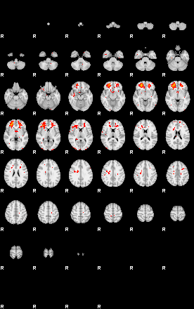 Patients 29008 126