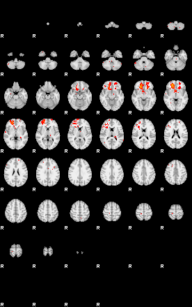 Patients 29010 126