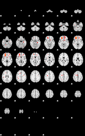 Patients 29015 124