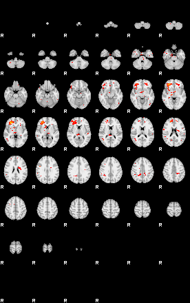 Patients 29017 125