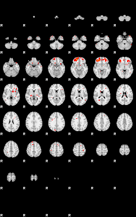 Patients 29052 1