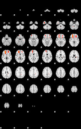 Patients 29070 110