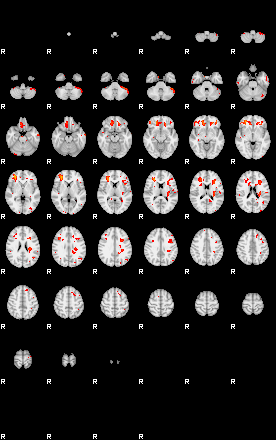 Patients 29097 43