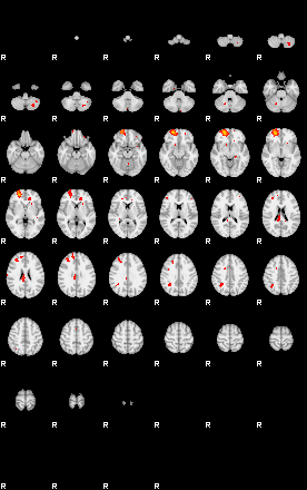 Patients 29160 126