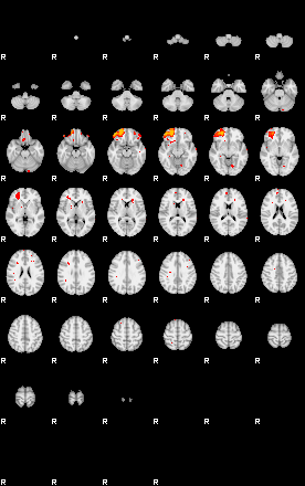 Patients 29167 127