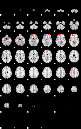 Patients 29175 121