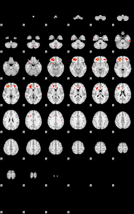 Patients 29184 114