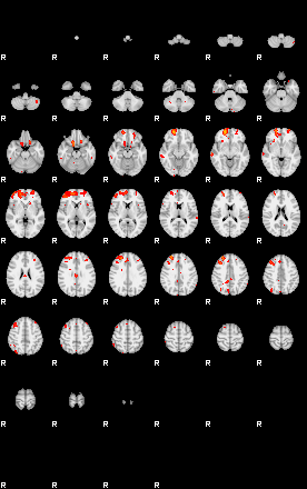 Patients 29206 153