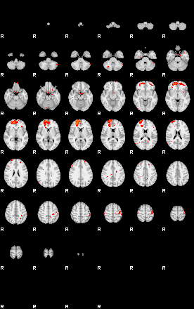 Patients 29216 124