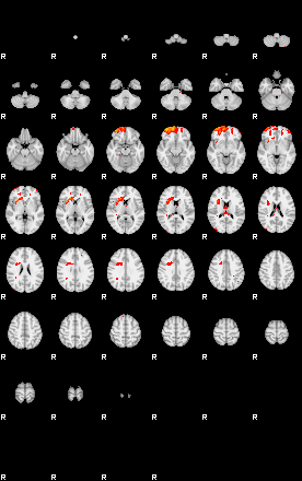 Patients 29292 144