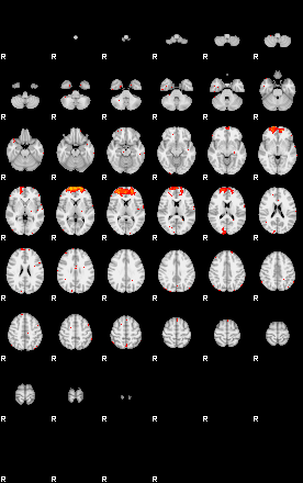 Patients 29591 100