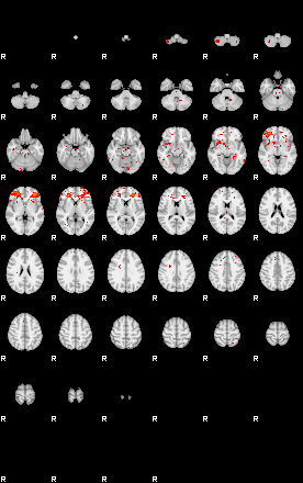 Patients 30000 158