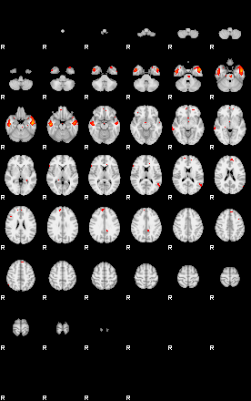 Patients 28718 14