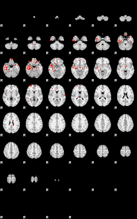 Patients 28942 5