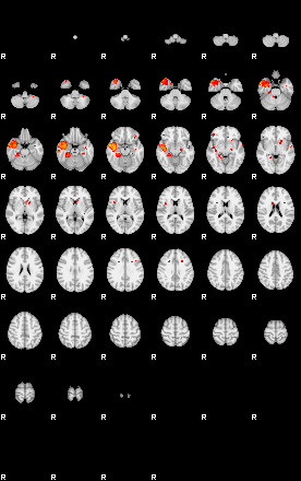 Patients 29067 3