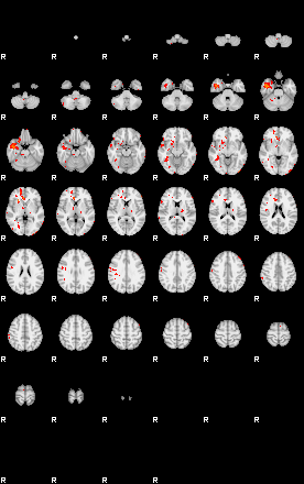 Patients 29433 140