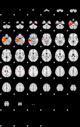 Patients 29503 3