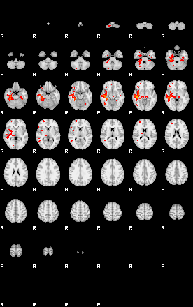 Patients 29062 80