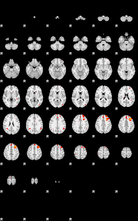 Patients 29153 50