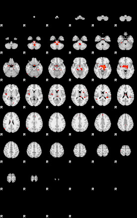 Patients 29099 85