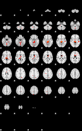 Patients 29160 60